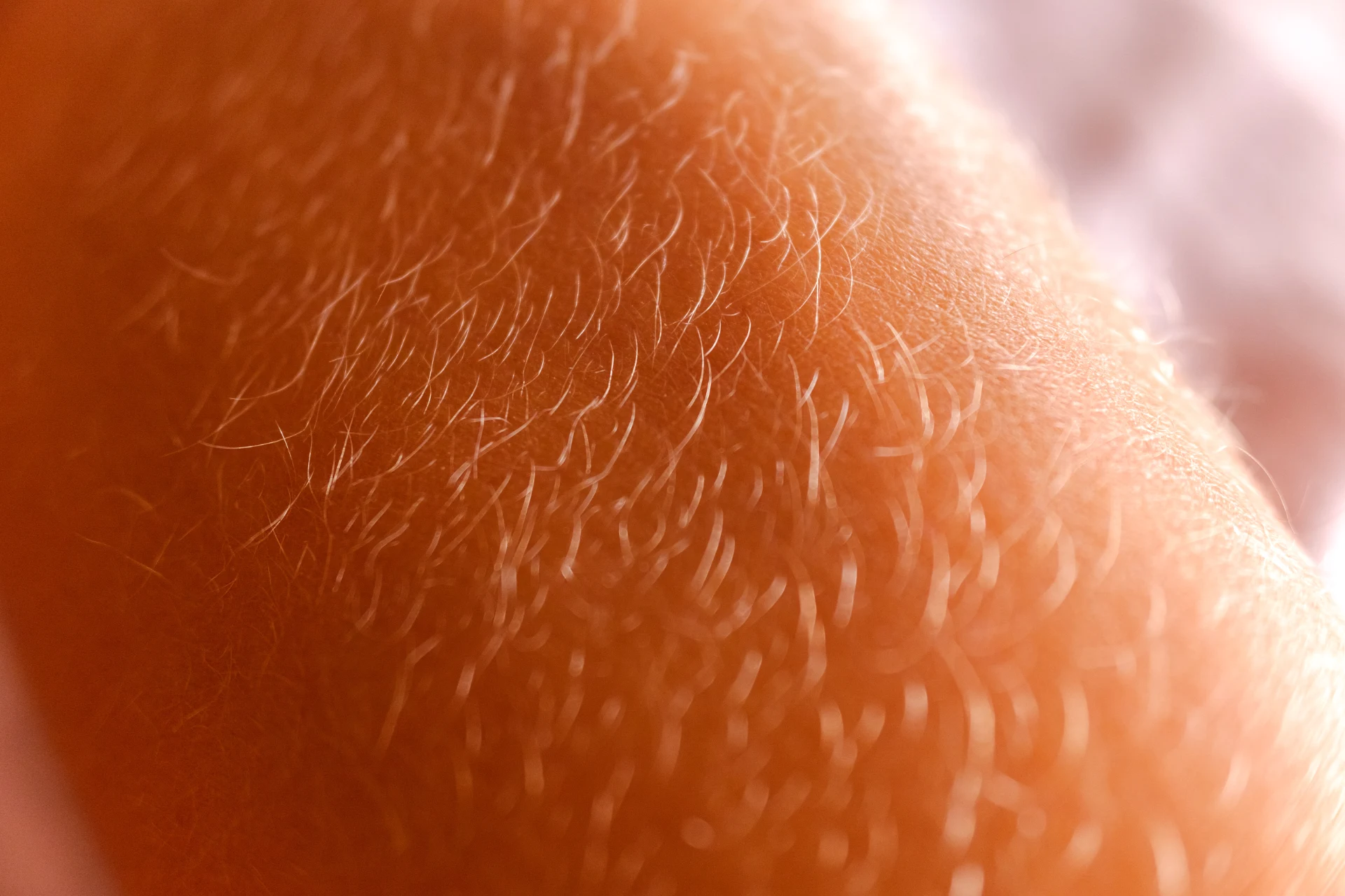 Epilazione laser - zoom su peli biondi e sottili del braccio